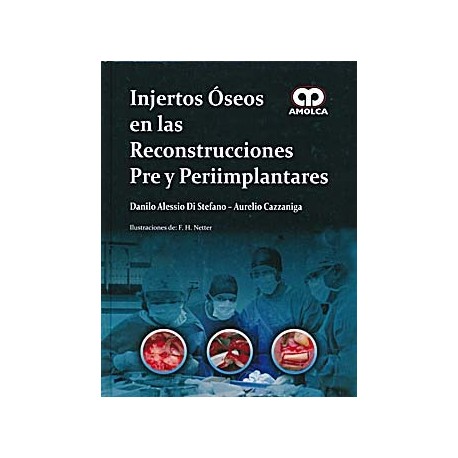 INJERTOS OSEOS EN LAS RECONSTRUCCIONES PRE Y PERIIMPLANTARES