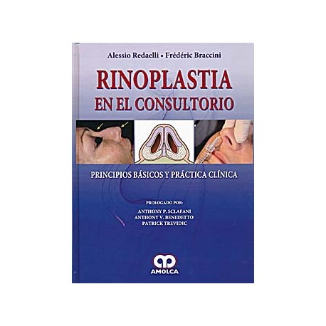 RINOPLASTIA EN EL CONSULTORIO. PRINCIPIOS BASICOS Y PRACTICA CLINICA