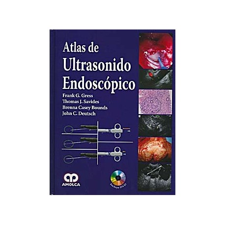 ATLAS DE ULTRASONIDO ENDOSCOPICO + DVD