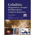 CELULITIS. DIAGNOSTICO Y TERAPIA DEL FIBROEDEMA EVOLUTIVO FEMENINO