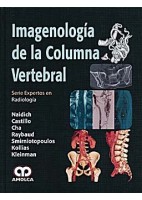 IMAGENOLOGIA DE LA COLUMNA VERTEBRAL