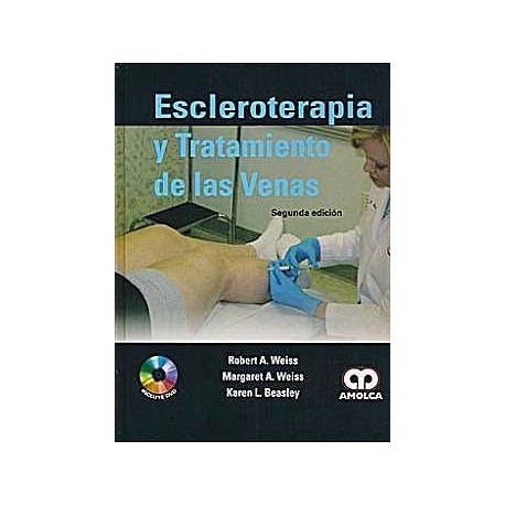 ESCLEROTERAPIA Y TRATAMIENTO DE LAS VENAS + DVD