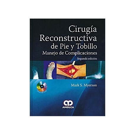 CIRUGIA RECONSTRUCTIVA DE PIE Y TOBILLO. MANEJO DE COMPLICACIONES + DVD