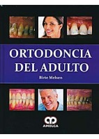 ORTODONCIA DEL ADULTO