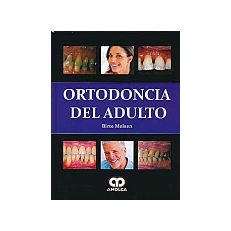 ORTODONCIA DEL ADULTO