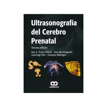 ULTRASONOGRAFIA DEL CEREBRO PRENATAL