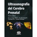 ULTRASONOGRAFIA DEL CEREBRO PRENATAL