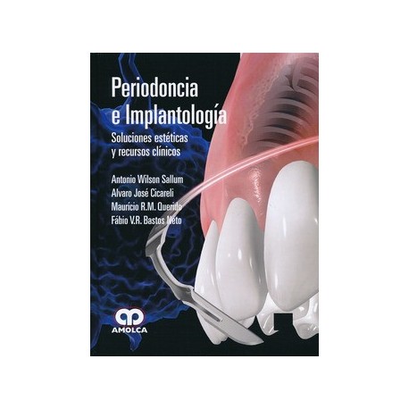 PERIODONCIA E IMPLANTOLOGIA. SOLUCIONES ESTETICAS Y RECURSOS CLINICOS