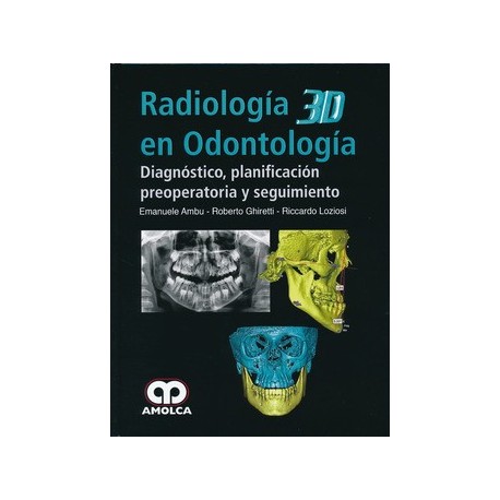 RADIOLOGIA 3D EN ODONTOLOGIA. DIAGNOSTICO, PLANIFICACION PREOPERATORIA Y SEGUIMIENTO