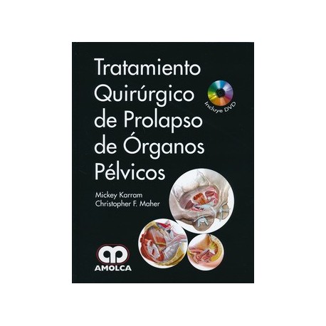 TRATAMIENTO QUIRURGICO DE PROLAPSO DE ORGANOS PELVICOS