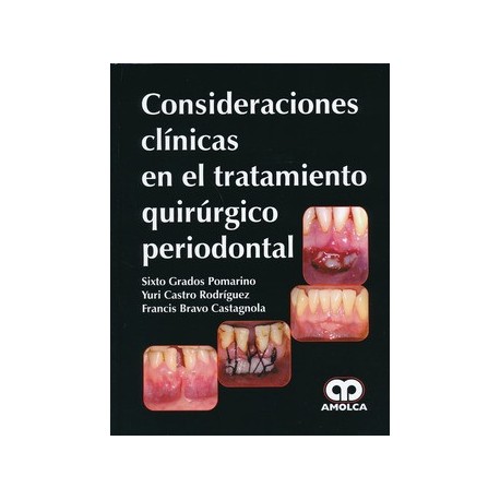 CONSIDERACIONES CLINICAS EN EL TRATAMIENTO QUIRURGICO PERIODONTAL