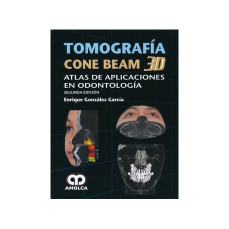 TOMOGRAFIA CONE BEAM 3D. ATLAS DE APLICACIONES EN ODONTOLOGIA
