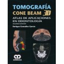 TOMOGRAFIA CONE BEAM 3D. ATLAS DE APLICACIONES EN ODONTOLOGIA