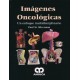 IMAGENES ONCOLOGICAS. UN ENFOQUE MULTIDISCIPLINARIO