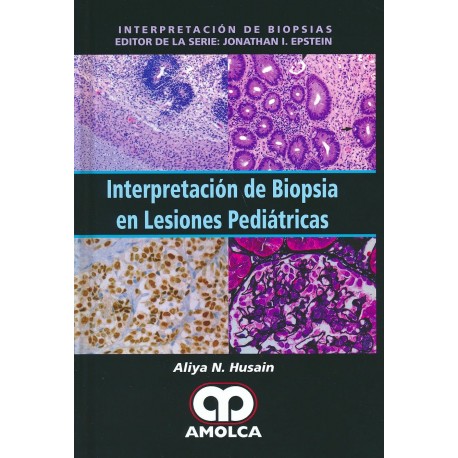 INTERPRETACION DE BIOPSIA EN LESIONES PEDIATRICAS (INTERPRETACION DE BIOPSIAS)