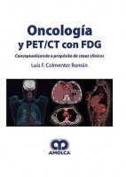ONCOLOGIA Y PET/CT CON FDG