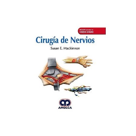 CIRUGIA DE LOS NERVIOS