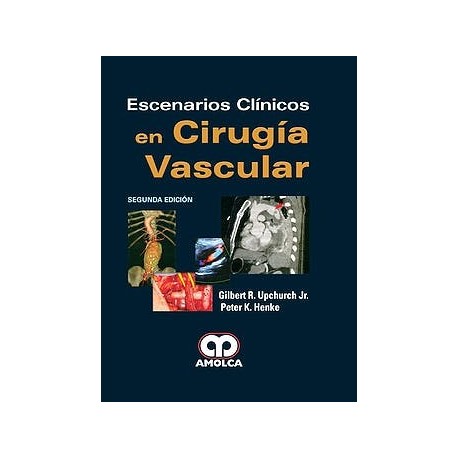 ESCENARIOS CLINICOS EN CIRUGIA VASCULAR