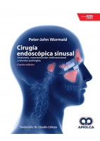 CIRUGIA ENDOSCOPICA SINUSAL
