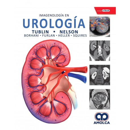 IMAGENOLOGIA EN UROLOGIA + E-BOOK