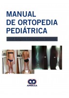 MANUAL DE ORTOPEDIA PEDIATRICA