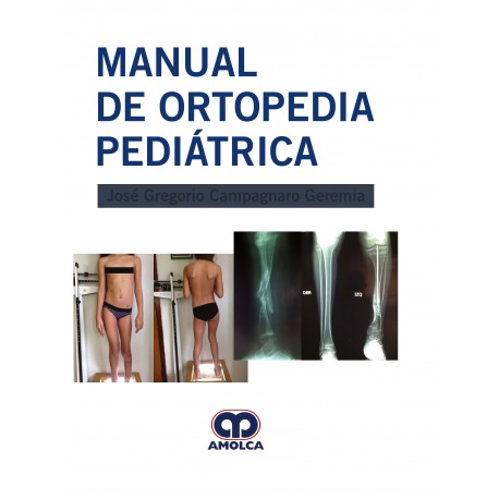 MANUAL DE ORTOPEDIA PEDIATRICA