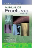 MANUAL DE FRACTURAS