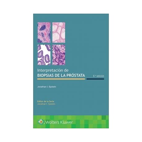 INTERPRETACION DE BIOPSIAS DE LA PROSTATA (INCLUYE EBOOK)