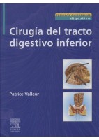 CIRUGIA DEL TRACTO DIGESTIVO INFERIOR