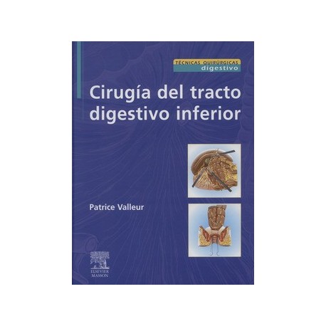 CIRUGIA DEL TRACTO DIGESTIVO INFERIOR