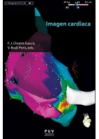 IMAGEN CARDIACA