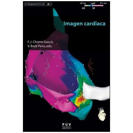 IMAGEN CARDIACA