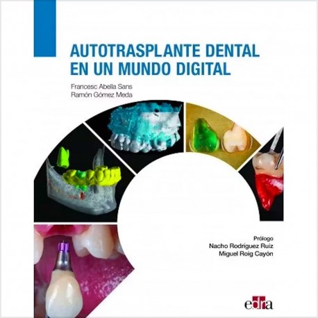 AUTOTRASPLANTE DENTAL EN UN MUNDO DIGITAL