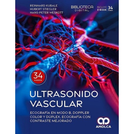 ULTRASONIDO VASCULAR. ECOGRAFIA EN MODO B, DOPPLER COLOR Y DUPLEX, ECOGRAFIA CON CONTRASTE MEJORADO