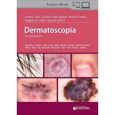 DERMATOSCOPIA
