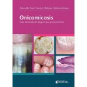 ONICOMICOSIS