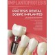 IMPLANTOPROTESIS. GUIA DE PROTESIS DENTAL SOBRE IMPLANTES