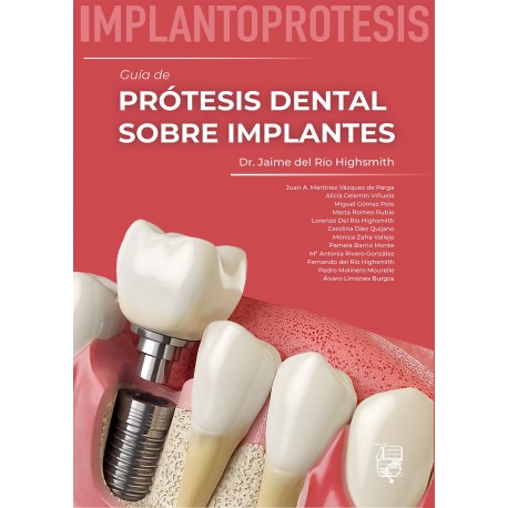 IMPLANTOPROTESIS. GUIA DE PROTESIS DENTAL SOBRE IMPLANTES