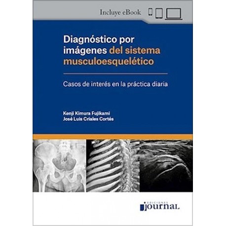 DIAGNOSTICO POR IMAGENES DEL SISTEMA MUSCULOESQUELETICO. CASOS DE INTERES EN LA PRACTICA DIARIA