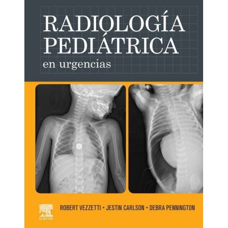 RADIOLOGIA PEDIATRICA EN URGENCIAS