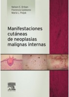 MANIFESTACIONES CUTANEAS DE NEOPLASIAS MALIGNAS INTERNAS