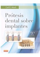 PROTESIS DENTAL SOBRE IMPLANTES