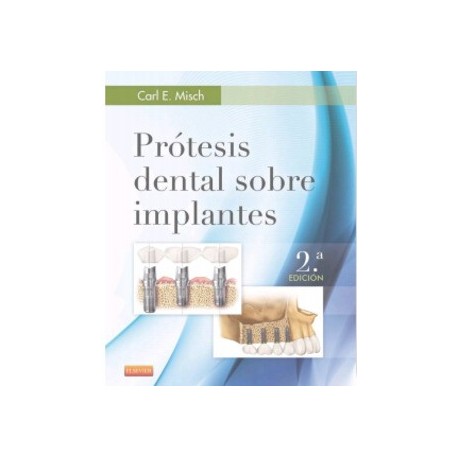 PROTESIS DENTAL SOBRE IMPLANTES