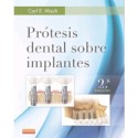 PROTESIS DENTAL SOBRE IMPLANTES