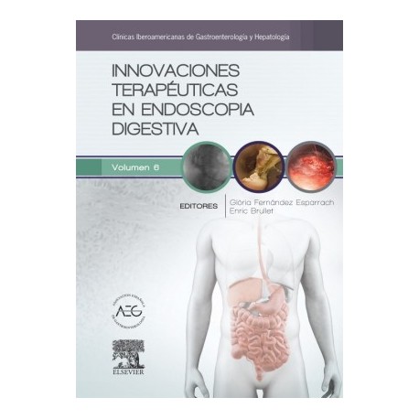 INNOVACIONES TERAPEUTICAS EN ENDOSCOPIA DIGESTIVA (CLINICAS IBEROAMERICANAS DE GASTROENTEROLOGIA Y HEPATOLOGIA, VOL. 6)