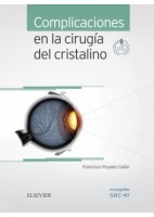COMPLICACIONES EN LA CIRUGIA DEL CRISTALINO