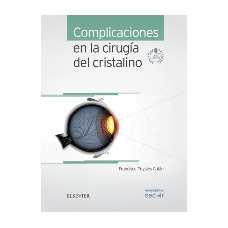 COMPLICACIONES EN LA CIRUGIA DEL CRISTALINO