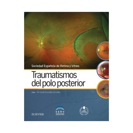 TRAUMATISMOS DEL POLO POSTERIOR