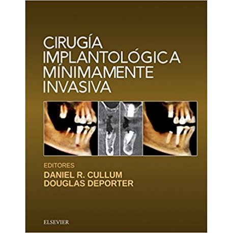 CIRUGIA IMPLANTOLOGICA MINIMAMENTE INVASIVA