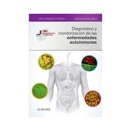 DIAGNOSTICO Y MONITORIZACION DE LAS ENFERMEDADES AUTOINMUNES